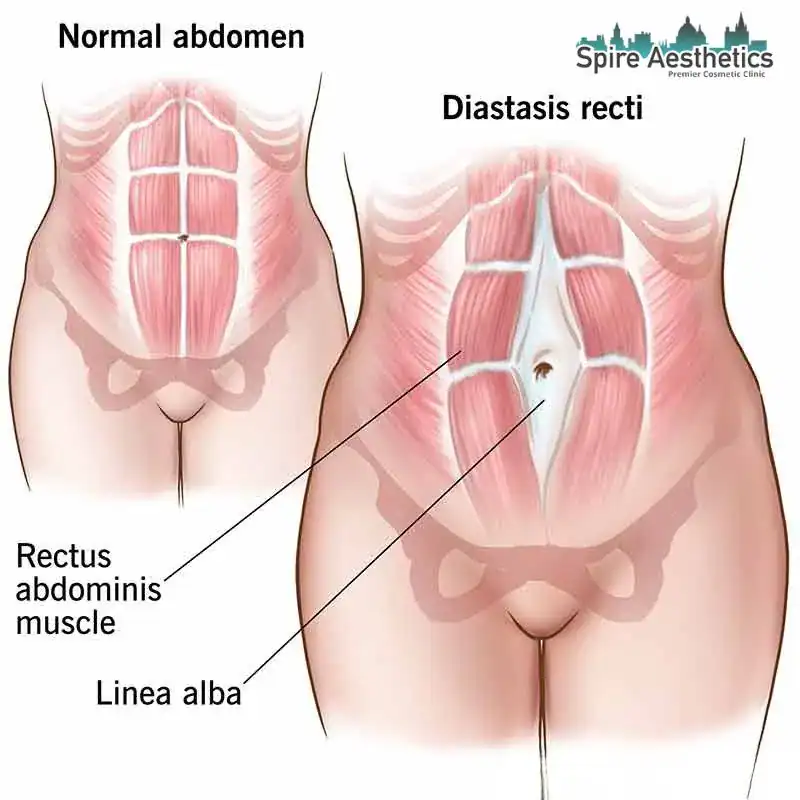 When Will My Belly Feel Normal Again Stoulton?